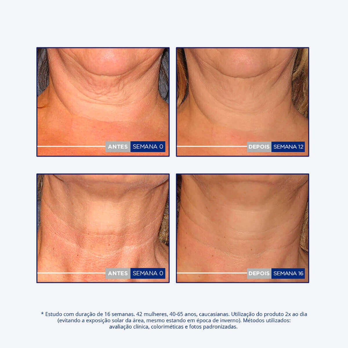 Creme Antissinais para Pescoço e Colo NeoStrata Skin Active Triple Firming Neck Cream com 80g