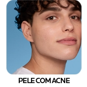 PELE COM ACNE